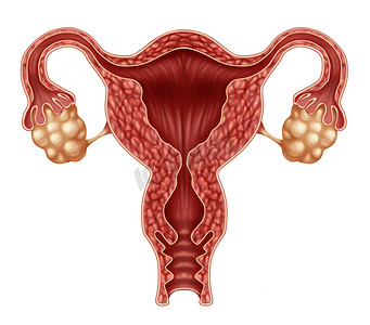 子宫和卵巢