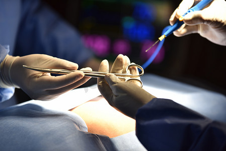 夹紧摄影照片_医疗团队在现代手术室进行外科手术。混合手术室的设备和医疗设备. 擦洗护士准备手术用的医疗器械.