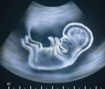 成象摄影照片_婴儿在母亲的子宫中的超声图像