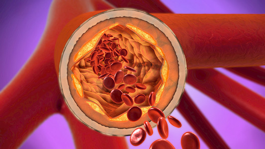 红色暗纹圈摄影照片_3d. 一个沉淀和收缩血管的图示或