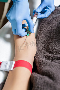 血液样本摄影照片_护士采取血液样本从病人的手臂。程序 Plasmolifting 血液的制备.