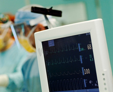 心脏监测摄影照片_心脏监视器，背景是外科医生。