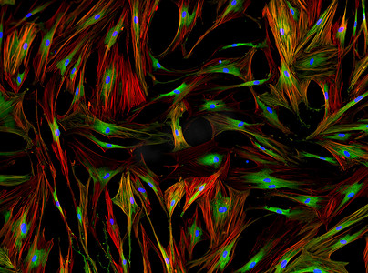 真正的荧光微观的人类细胞---人类肺 f