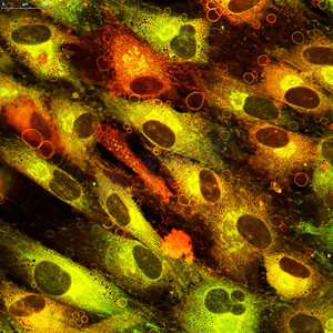 绿色科技医疗摄影照片_神经酰胺在人类细胞系
