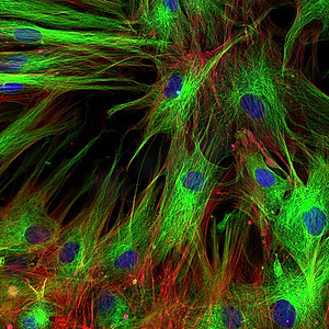 成纤维细胞 （皮肤细胞） 用荧光染料标记