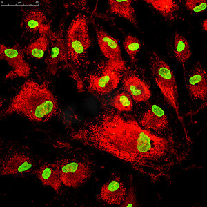 药物分子摄影照片_荧光分子标记的骨髓间充质干细胞