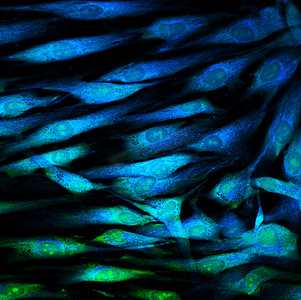 科技医疗绿色摄影照片_成纤维细胞 （皮肤细胞） 用荧光染料标记