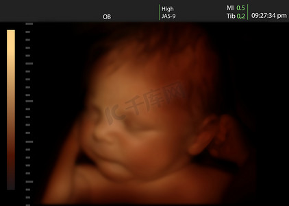 刚出生的婴儿，像三维超声的婴儿在母亲的子宫里的形象