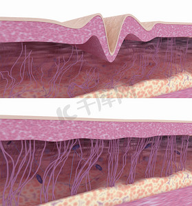 皱纹的摄影照片_皮肤年轻化。胶原纤维和弹性纤维的重建.3D渲染说明.