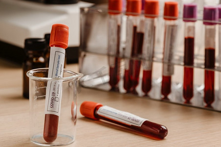 试管中的COVID—19血液检测，用于诊断新型冠状病毒感染的血液检测样本（新型冠状病毒病2019）