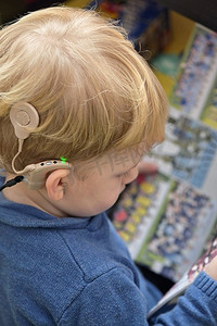 助听器和耳蜗植入物的男孩
