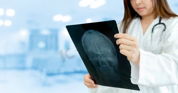 女医生或外科医生在医院检查病人的x光图像。医疗保健和医生服务。