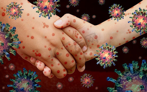  麻疹，疾病，风疹，传染性