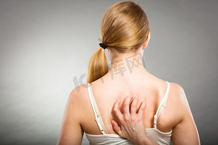 健康问题，皮肤病。一名年轻女子因过敏性皮疹挠她发痒的背部。一名妇女因过敏性皮疹挠她发痒的背部