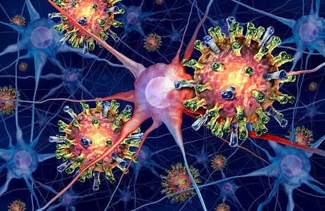 脑炎感染是一种麻疹病毒在大脑中感染微观神经元的一种病毒性脑膜炎概念，是一种3D渲染。