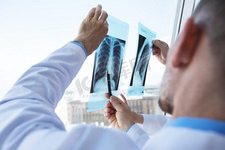 医疗保健，医疗：一群医生在诊所或医院里讨论和看X光片。医生讨论和看x光