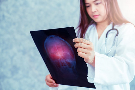 医疗片头摄影照片_年轻的女医生在医院看病人的头部或脑部疾病的x光片。医疗保健和医疗服务理念。