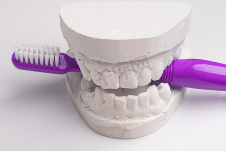 刷口摄影照片_口腔卫生健康概念。特写紫色牙刷在牙科石膏模型石膏