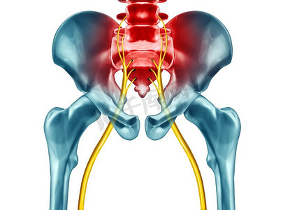 坐骨神经痛疼痛症状和诊断医疗概念作为疾病引起身体问题与3D例证元素在白色背景