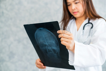年轻女医生在医院看病人头部或脑部疾病的X光片。医疗保健和医疗服务理念。