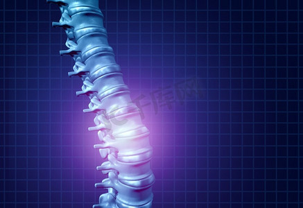 骨质疏松海报摄影照片_背部、脊椎、关节、骨骼