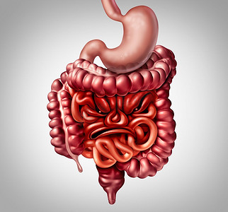 疼痛摄影照片_综合征、肠易激综合征、腹部、疼痛