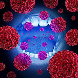 口腔癌医学概念为口腔恶性疾病细胞与3D插图元素。