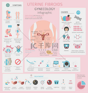 子宫肌瘤。Ginecological 妇女图表的医疗疾病。矢量插图