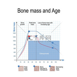 传染背景图片_男性和女性的骨量。年龄和骨质疏松症。图表。健康的生活方式。传染媒介例证为教育、科学和医疗用途