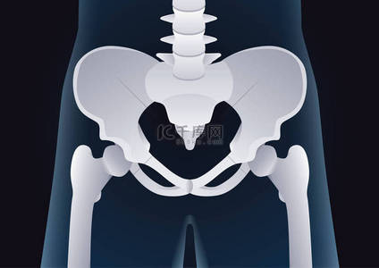 盆腔疼痛背景图片_正常的人体骨盆骨在 x 射线概念的形状.