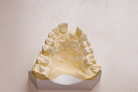 牙科石膏模型研究