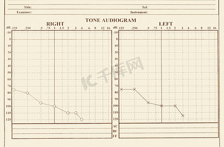 力学摄影照片_听力医疗图表显示，听力学