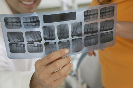 牙医拿着病人的牙齿 x 光报告