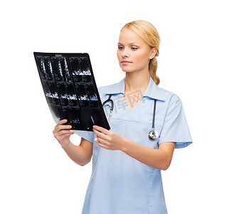 脊髓icon摄影照片_看 X-射线的严肃的医生或护士