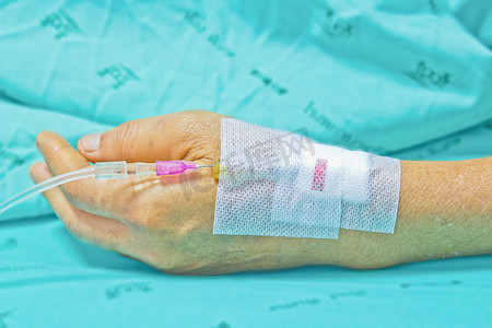 一位在医院接受生理盐水静脉注射的女性患者的特写