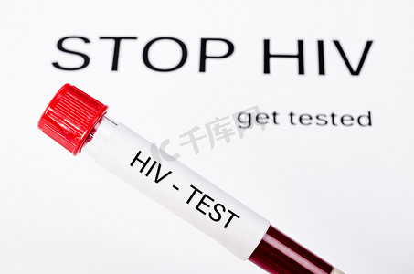 停止 HIV 测试的 HIV 测试血液样本得到测试。