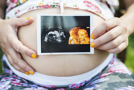 孕妇抱子宫图片
