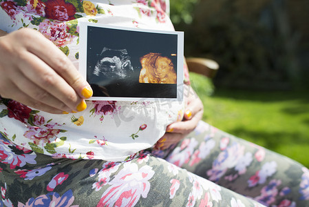 孕妇抱子宫图片