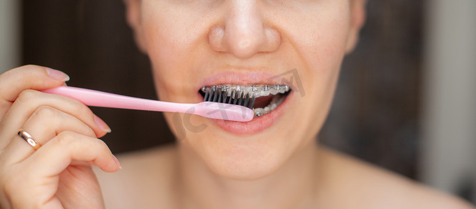 牙齿上戴牙套的女孩用牙刷刷牙