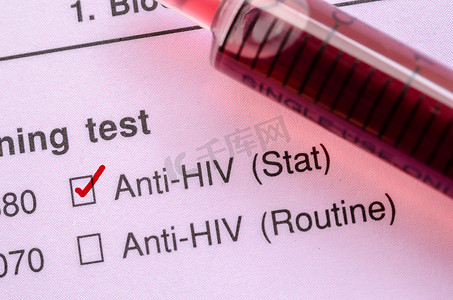 带有用于 HIV 检测的血样的红色正确复选标记。