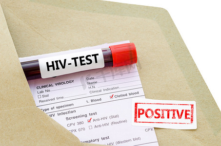 HIV 检测呈阳性的血液样本。