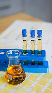 饼图配色摄影照片_带有尿液的烧瓶和试管采用医学配色方案。