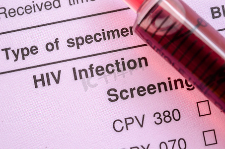 HIV 感染筛查测试表。