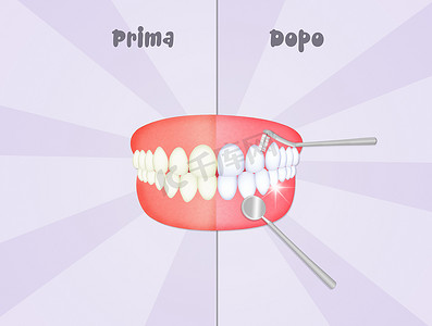 清洁牙齿之前和之后