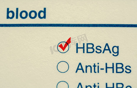 检查标记乙型肝炎病毒测试形式。
