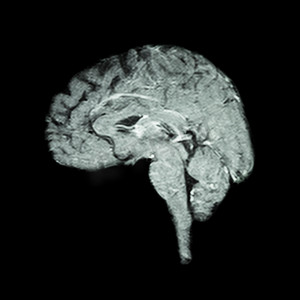 大脑磁共振成像 (MRI)（医学、科学和医疗保健概念）
