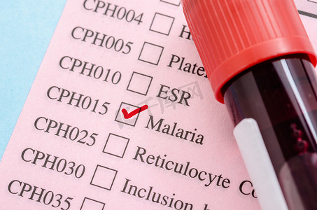 疟疾测试表格纸上的样本血管。