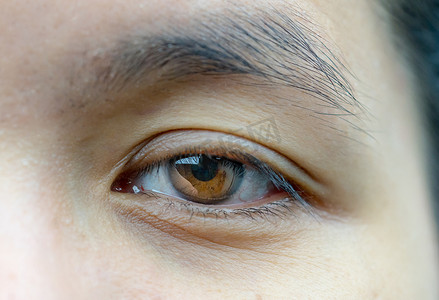 亚洲中年妇女棕色眼睛的宏观照片，眼睛下方有皱纹，眼中有静脉。