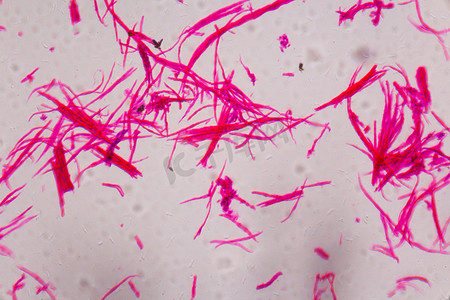 平滑肌在显微镜下分离 — 抽象粉色线