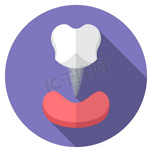 平面设计现代矢量图的牙齿植入物图标与长长的影子，孤立